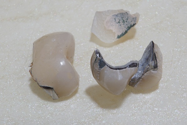 Close-up of a dental crown being held next to a temporary repair kit