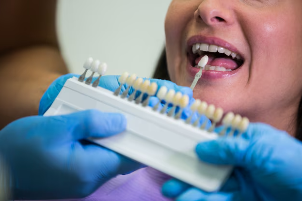 dental crowns walnut creek