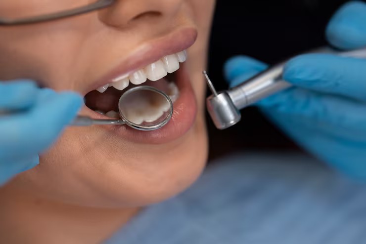 dental crowns in Walnut Creek