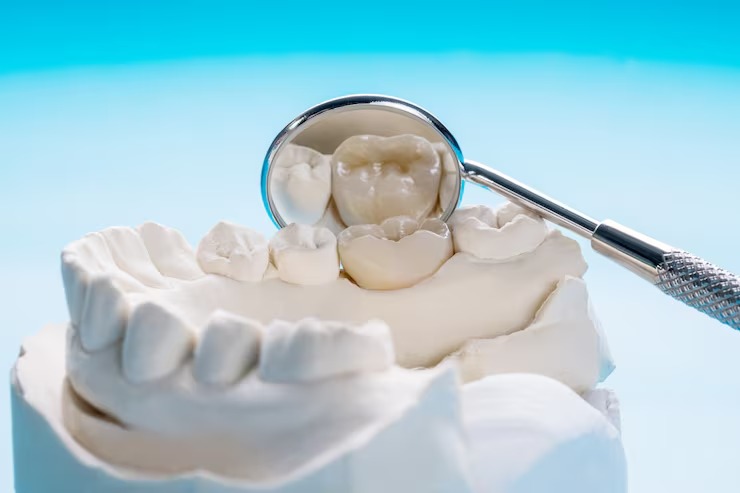 dental procedure